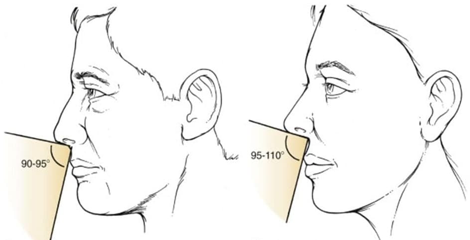 correzione-punta-naso-con-modifica-angolo-naso-labiale.jpg