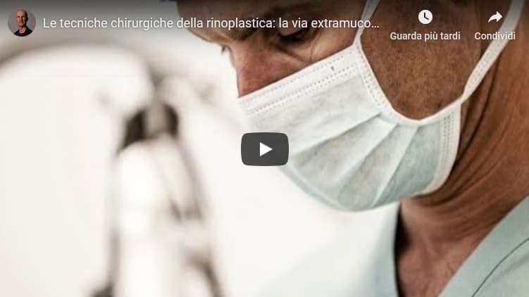 video-tecnica-chirurgica-rinoplastica-via-extramucosa.jpg