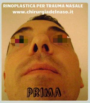 big_frontale-prima_primadopo_34_08J5d (1).jpg
